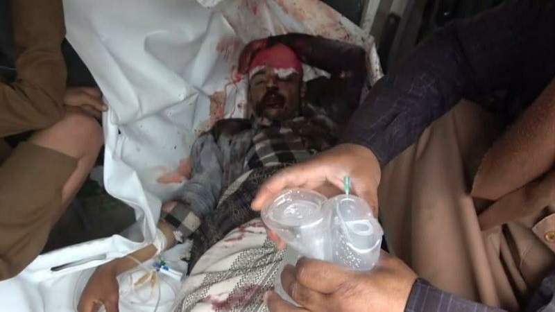 Civilian Critically Injured by US-Saudi Mercenaries' Bullet in Taiz