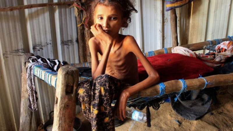 Huge Financial Allocations for Saudi-backed Government While Yemenis Starving to Death