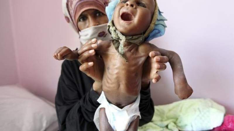 US-Saudi Aggression Launches New Phase of Starvation War against Yemenis