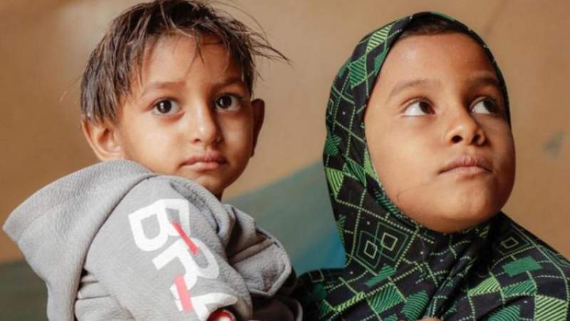 Unicef Urges Lifesaving Action for Children with Severe Malnutrition, in Yemen
