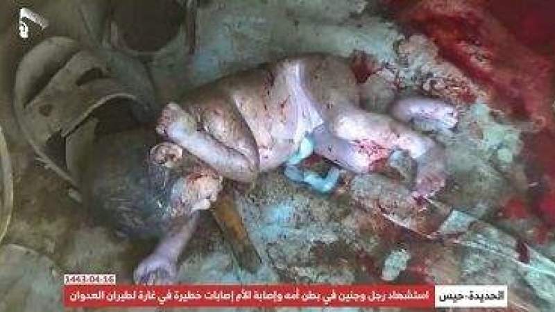 American Air Strike Abort 9 Months Mother, Kills Baby and Husband in Yemen