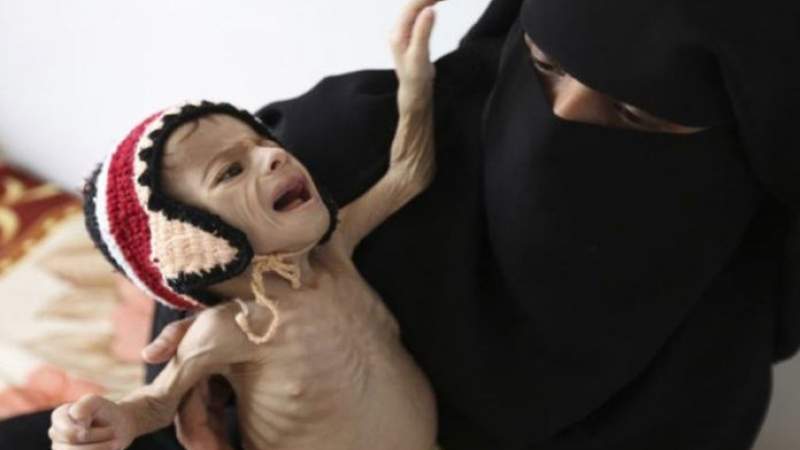 Sana'a Calls on Countries of World to Elevate Tragedy of Yemeni Children