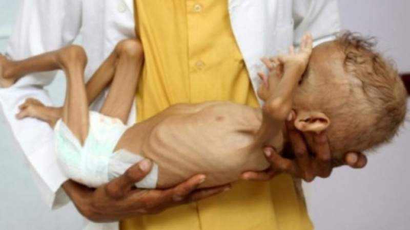 World Bank: A Quarter of Yemen's Population Faces Food Insecurity