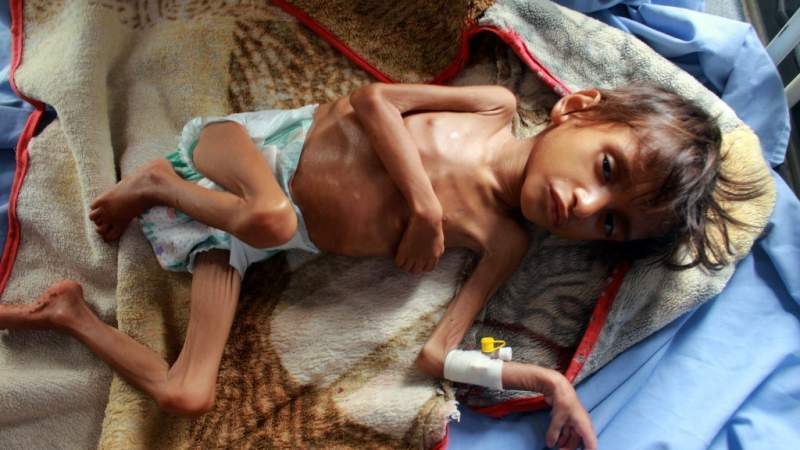 WFP Says It Needs $2 Billion in Yemen