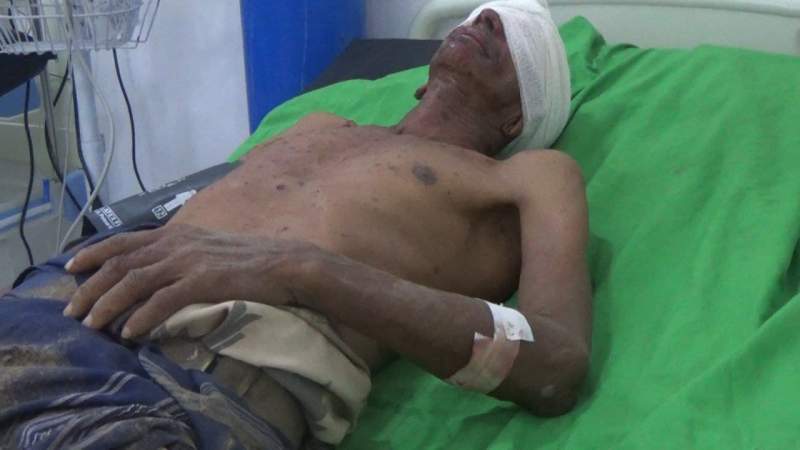 Citizen Seriously Injured by US-Saudi-Emirati Airstrike in Taiz Governorate