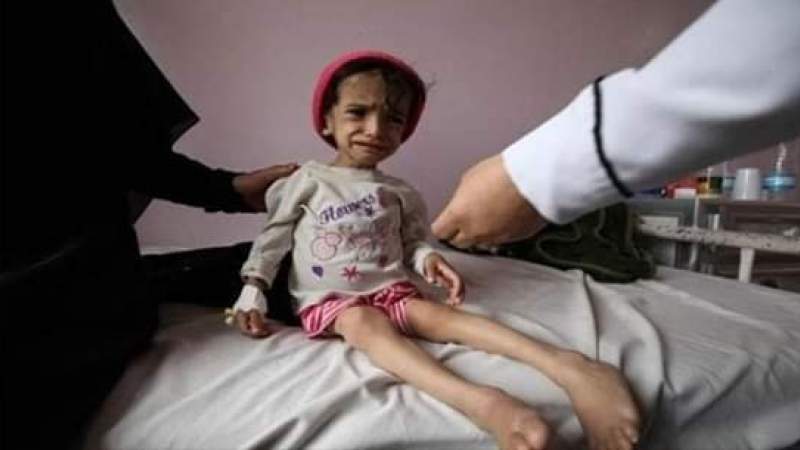 Childhood in Yemen Most Affected by Aggression, International Organizations 