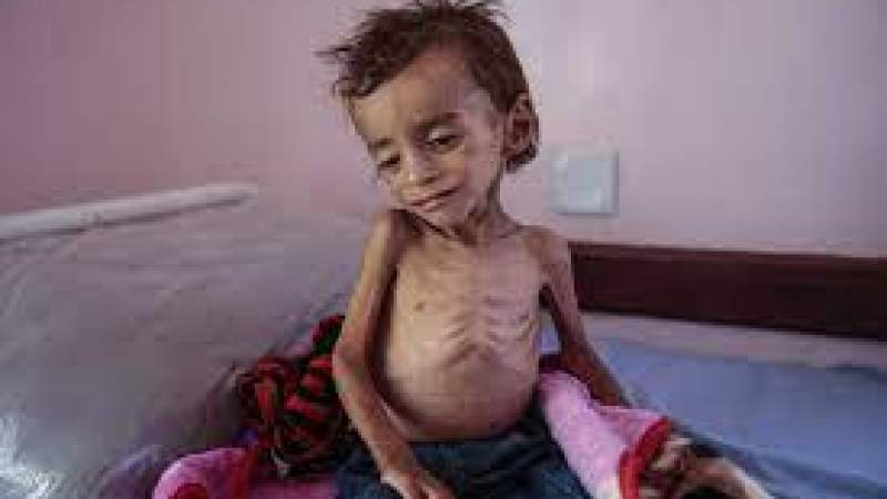Senators Call on Biden Administration to Demand Saudi End Blockade Tactics on a Starving Yemen 
