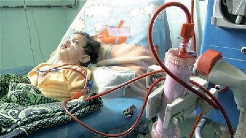 Amid US-Saudi Aggression and Siege, 18,000 Yemenis in Urgent Need of Liver Transplantation