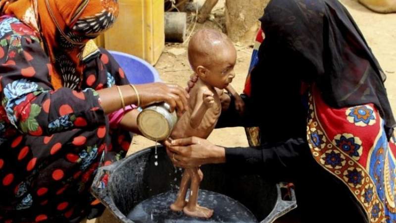Hunger Issue in Yemen Used for Collecting Money for International Organizations