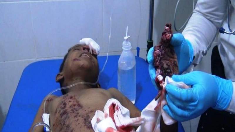 Bombs, Remnants of US-Saudi Weapons Continue to Claim Civilian Lives in Yemen