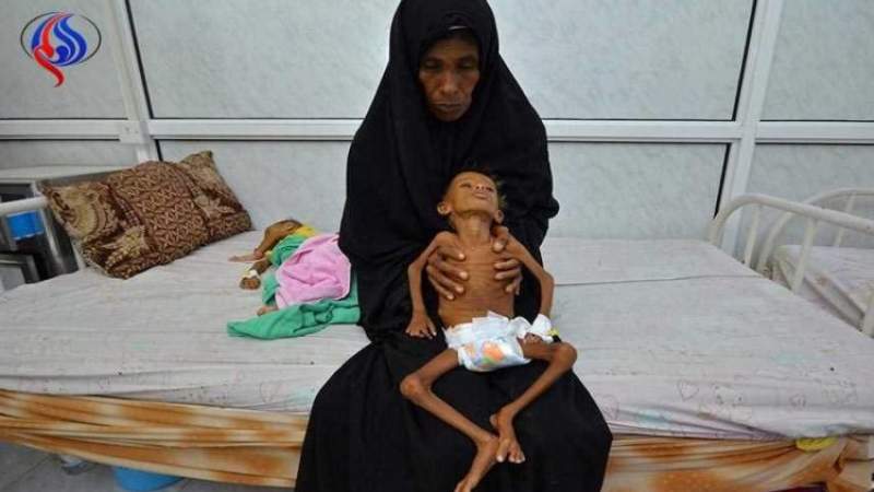 FAO Exploits Food Insecurity in Yemen, Raises $50 Million to Squander